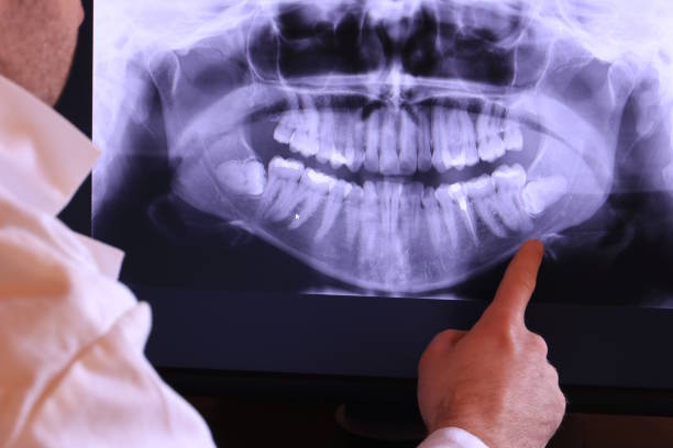 Best Same-Day Emergency Dentist in Beggs, OK