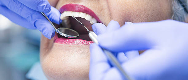 Best Emergency Root Canal Treatment in Beggs, OK